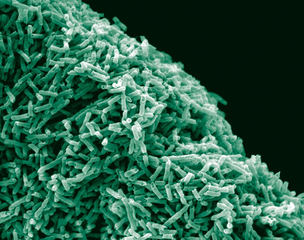 Escherichia coli colony